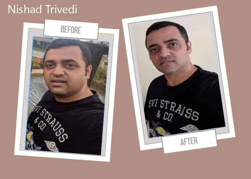 Nihar Trivedi — transformation